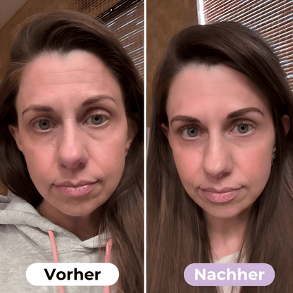 ScarRelief ™ | Silikon-Narbenpflaster